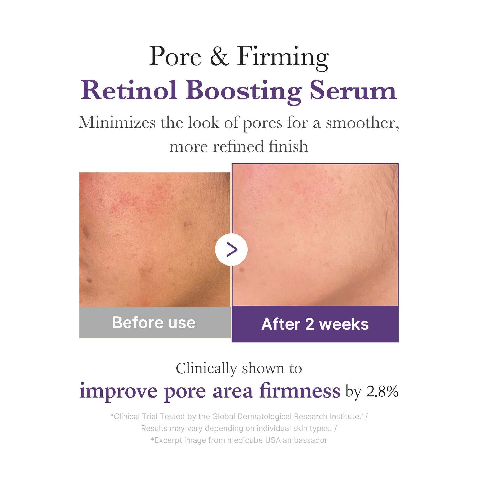[Medicube] Retinol NMN Boosting Serum