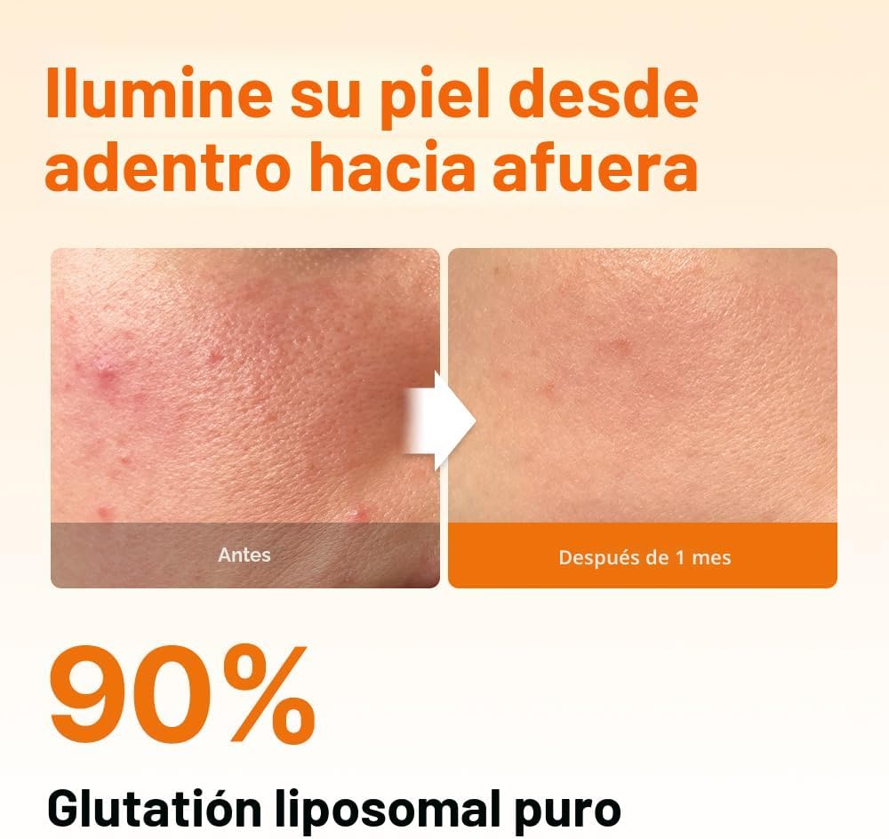 [Esther Formula] Liposome Glutathione Direct Ultra X