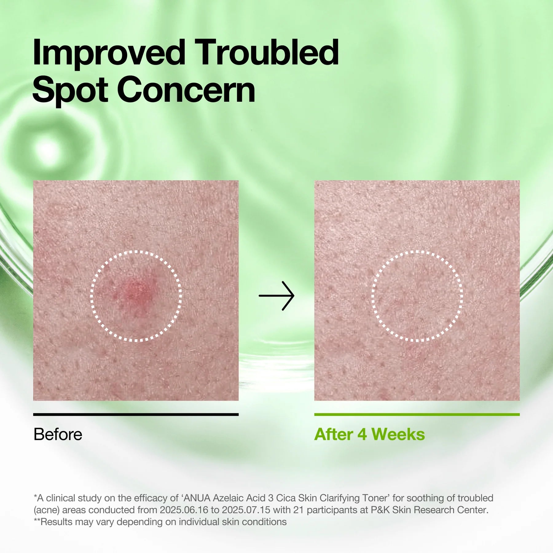 [ANUA] Azelaic Acid 3 Cica Skin Clarifying Toner