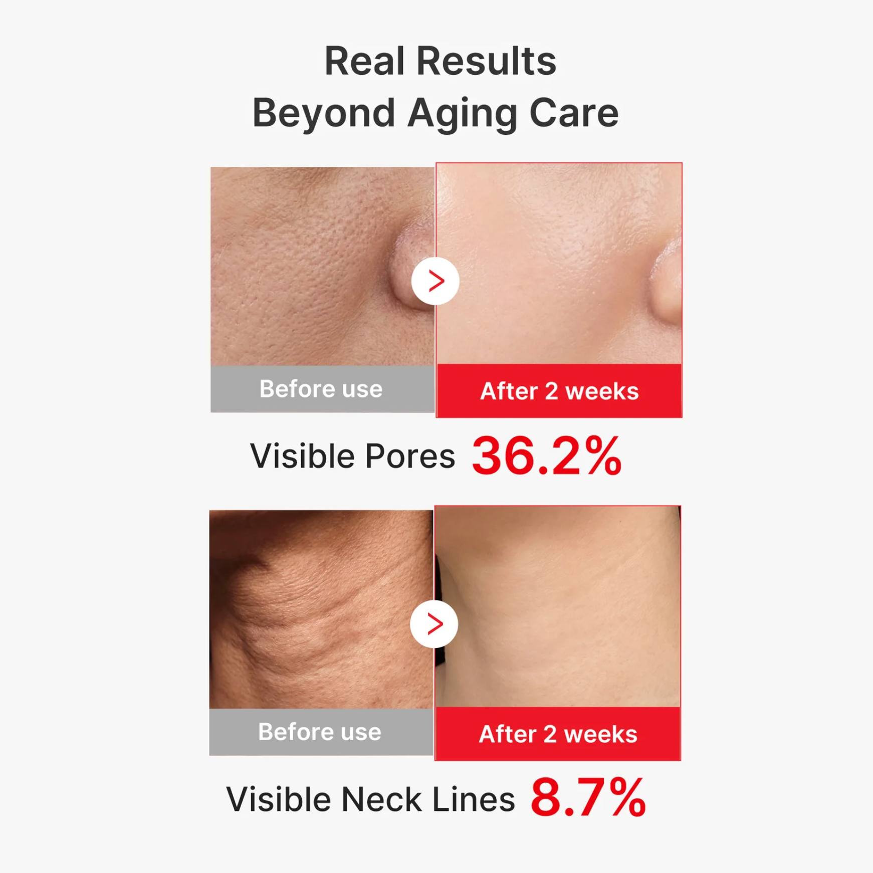 [Medicube] EGF NAD+ Firming Serum