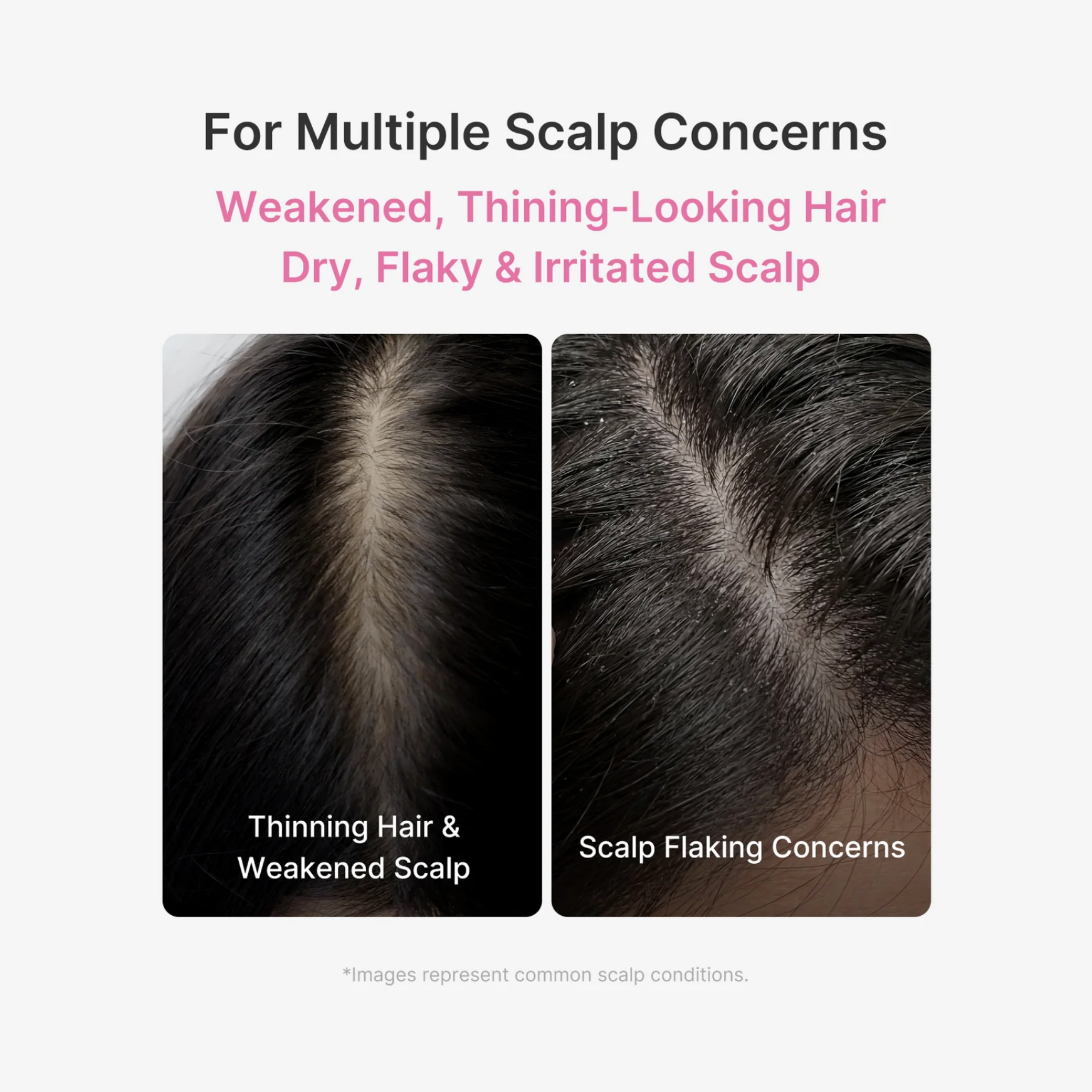 [Medicube] Rosemary PDRN Scalp Serum