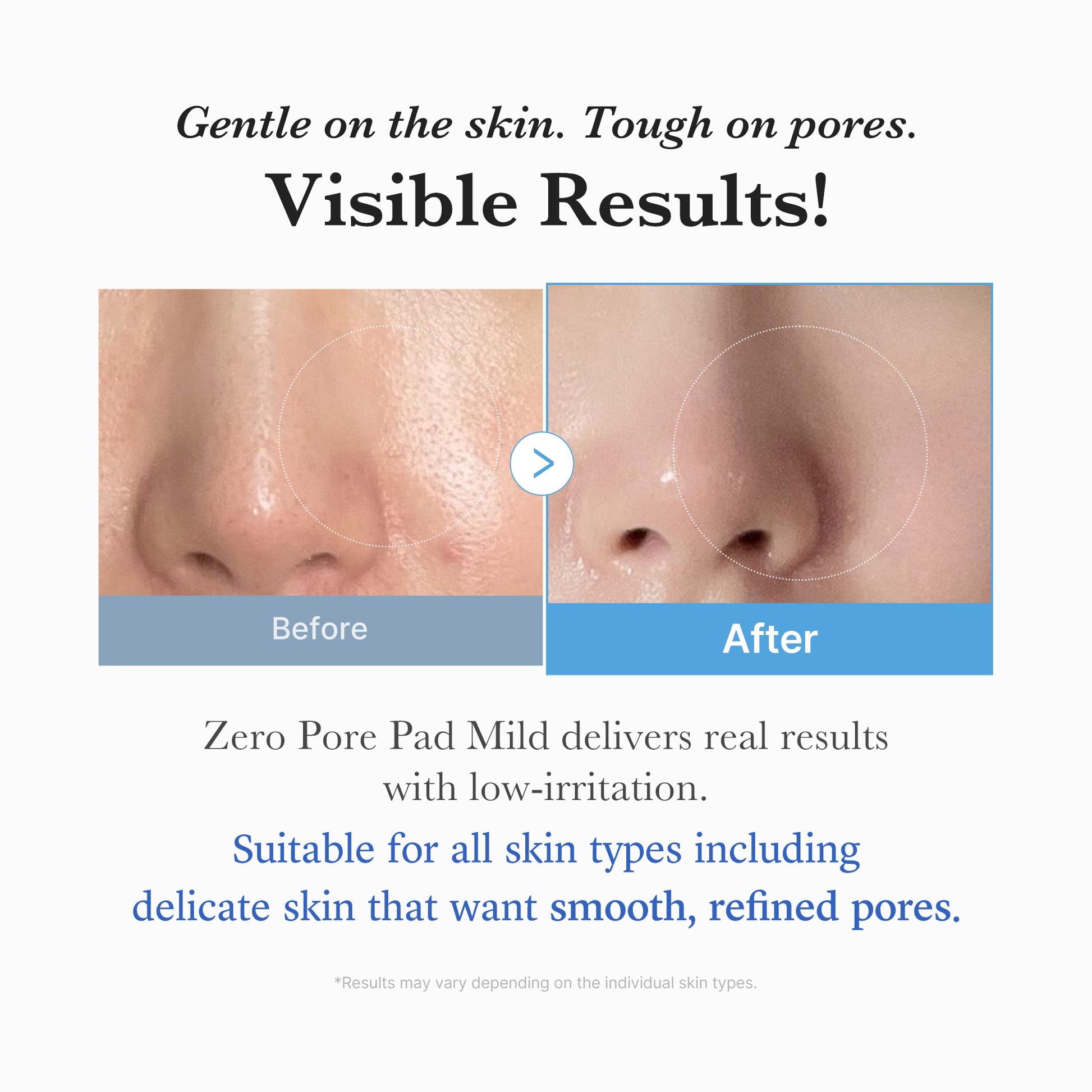 [Medicube] Zero Pore Pad Mild