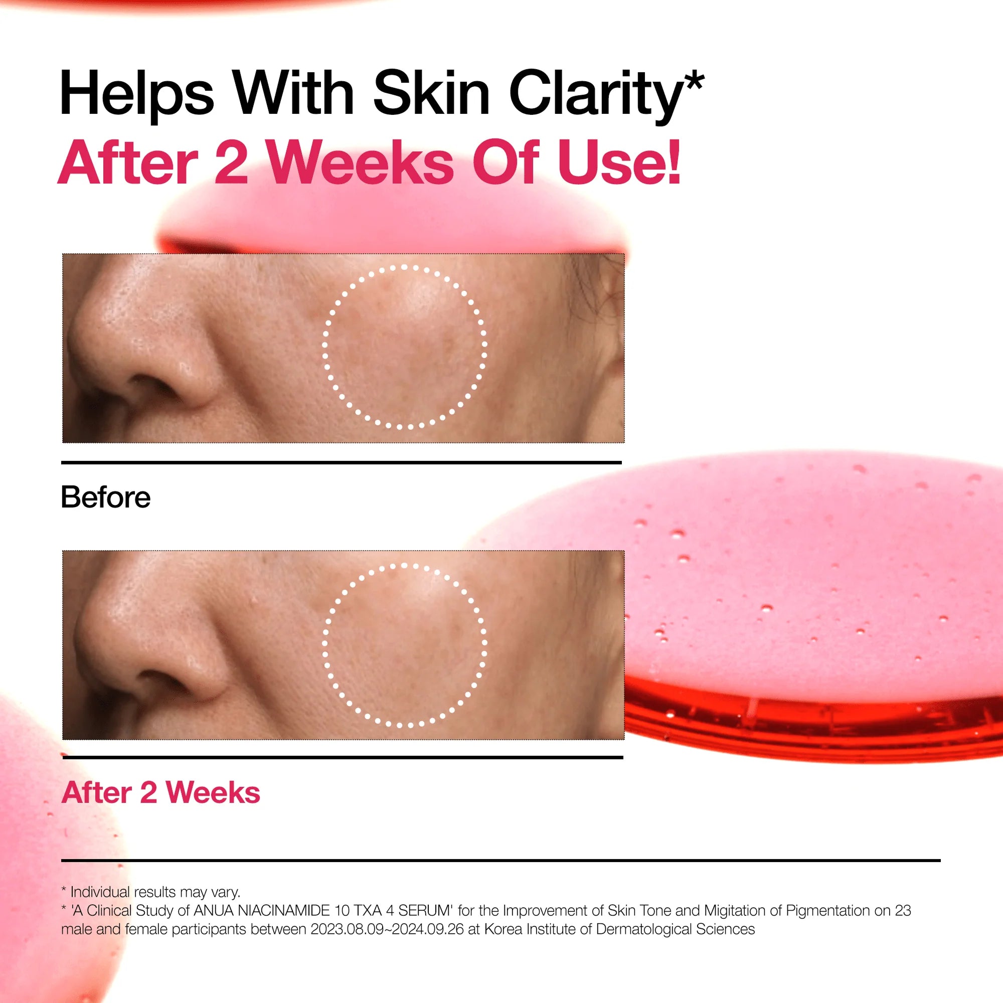 [ANUA] Niacinamide 10% + TXA 4% Serum