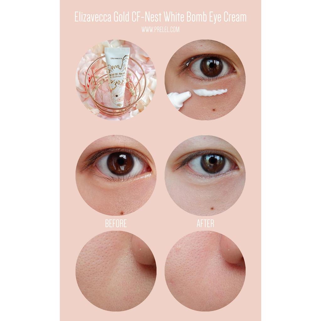 [Elizavecca] Gold CF-Nest white-bomb Eye Cream