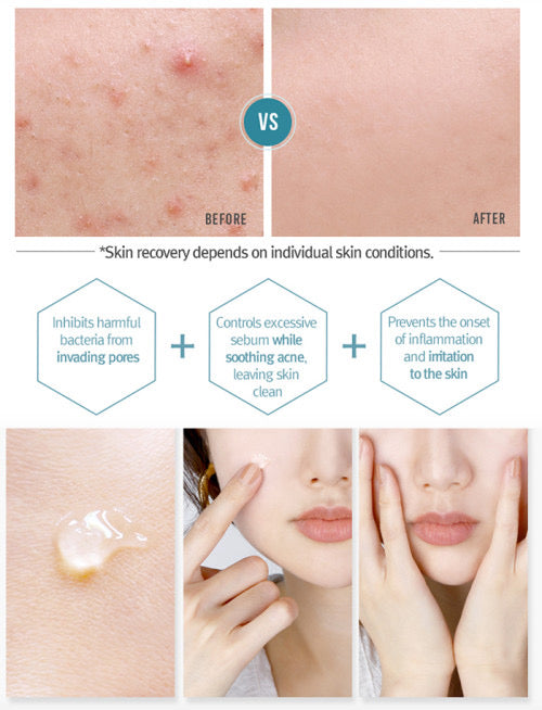 [Pyunkang yul] Acne Facial Cleanser